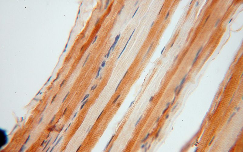 Immunohistochemical of paraffin-embedded human skeletal muscle using Catalog No:108748(CA3 antibody) at dilution of 1:100 (under 40x lens)
