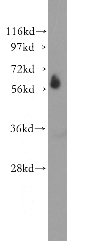human skin tissue were subjected to SDS PAGE followed by western blot with Catalog No:116920(ZBTB7B antibody) at dilution of 1:400