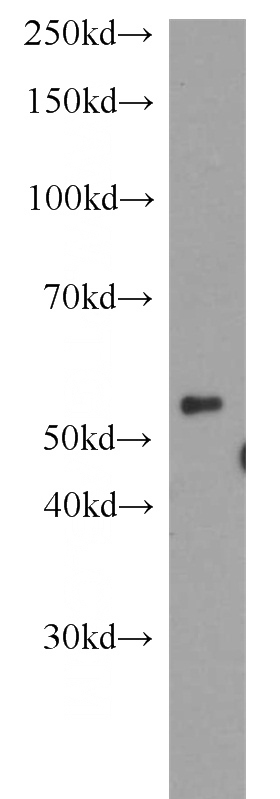 HeLa cells were subjected to SDS PAGE followed by western blot with Catalog No:110066(DPH2 antibody) at dilution of 1:800