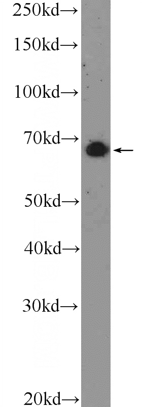 mouse brain tissue were subjected to SDS PAGE followed by western blot with Catalog No:112434(MAPK4 Antibody) at dilution of 1:1000