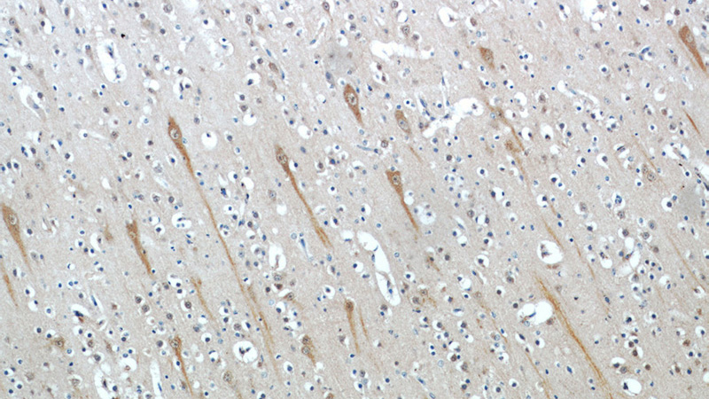Immunohistochemical of paraffin-embedded human brain using Catalog No:116091(TMEM106B antibody) at dilution of 1:100 (under 10x lens)