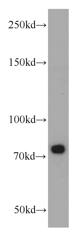 mouse testis tissue were subjected to SDS PAGE followed by western blot with Catalog No:115787(SYNPO2L antibody) at dilution of 1:300