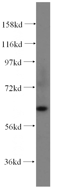 human heart tissue were subjected to SDS PAGE followed by western blot with Catalog No:115812(STXBP4 antibody) at dilution of 1:800