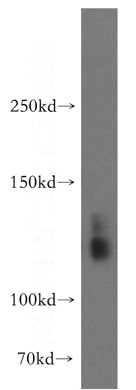 human brain tissue were subjected to SDS PAGE followed by western blot with Catalog No:115342(SLC4A8 antibody) at dilution of 1:300