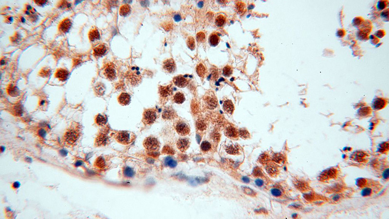 Immunohistochemical of paraffin-embedded human testis using Catalog No:113158(NFKB2,p52,p100-Specific antibody) at dilution of 1:50 (under 40x lens)