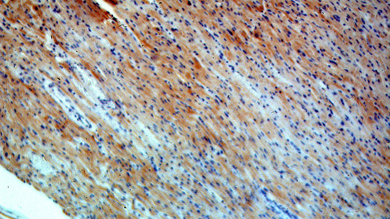 Immunohistochemical of paraffin-embedded human heart using Catalog No:109502(COX8A antibody) at dilution of 1:100 (under 10x lens)