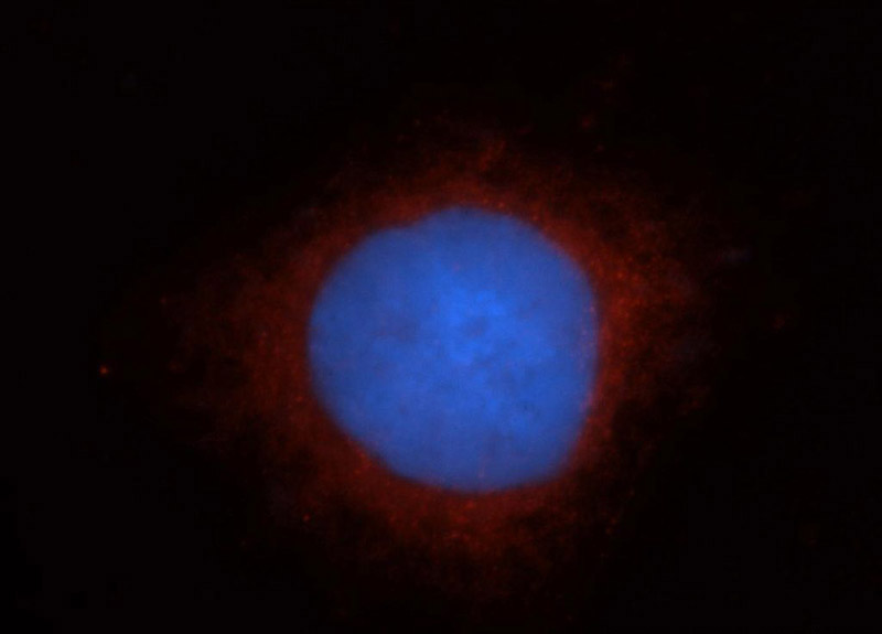 Immunofluorescent analysis of Hela cells, using TRAK2 antibody Catalog No:116238 at 1:50 dilution and Rhodamine-labeled goat anti-rabbit IgG (red). Blue pseudocolor = DAPI (fluorescent DNA dye).
