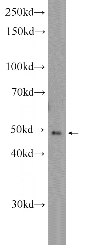 human testis tissue were subjected to SDS PAGE followed by western blot with Catalog No:117015(ZNF645 Antibody) at dilution of 1:1000