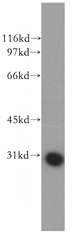 human heart tissue were subjected to SDS PAGE followed by western blot with Catalog No:110972(GIMAP2 antibody) at dilution of 1:300