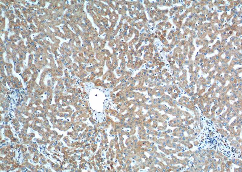 Immunohistochemistry of paraffin-embedded human liver tissue slide using Catalog No:116173(TOMM40 Antibody) at dilution of 1:200 (under 10x lens).