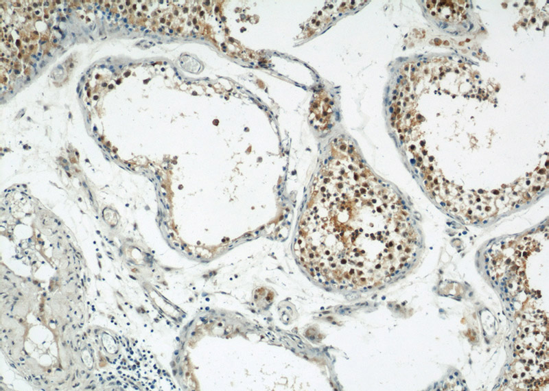 Immunohistochemical of paraffin-embedded human testis using Catalog No:112333(LRRC41 antibody) at dilution of 1:50 (under 10x lens)
