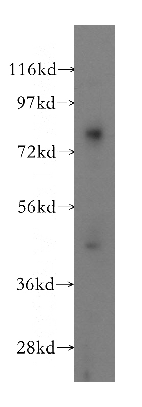 HEK-293 cells were subjected to SDS PAGE followed by western blot with Catalog No:110961(GGT5 antibody) at dilution of 1:400