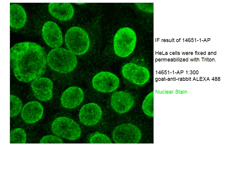 IF result of anti-TMPO(Catalog No:112141) in Hela cell by Dr. Ralph Kehlenbach.