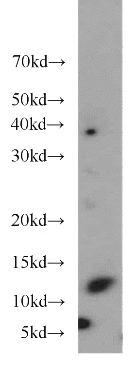 PC-3 cells were subjected to SDS PAGE followed by western blot with Catalog No:116119(TIAF1 antibody) at dilution of 1:1500