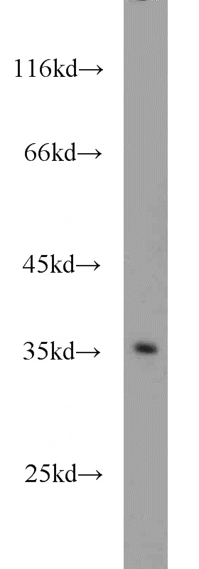 mouse brain tissue were subjected to SDS PAGE followed by western blot with Catalog No:115802(SDCBP2 antibody) at dilution of 1:1000
