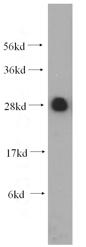 HeLa cells were subjected to SDS PAGE followed by western blot with Catalog No:114875(RPL19 antibody) at dilution of 1:500