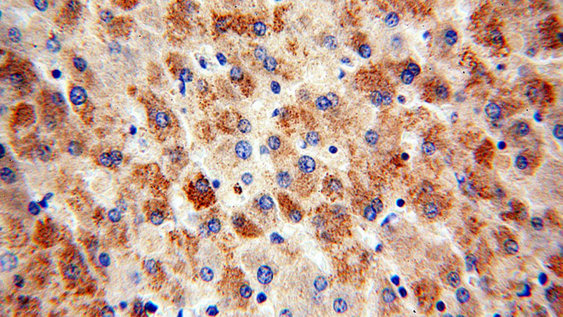 Immunohistochemical of paraffin-embedded human liver using Catalog No:110361(ERK1/2 antibody) at dilution of 1:100 (under 40x lens)