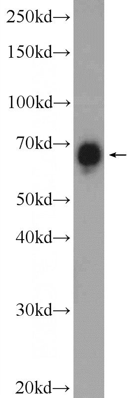 HeLa cells were subjected to SDS PAGE followed by western blot with Catalog No:117231(BRD9 Antibody) at dilution of 1:1000