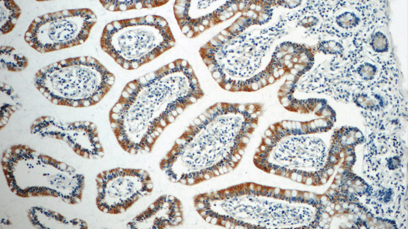 Immunohistochemistry of paraffin-embedded human small intestine tissue slide using Catalog No:114459(RAB7B Antibody) at dilution of 1:50 (under 10x lens)