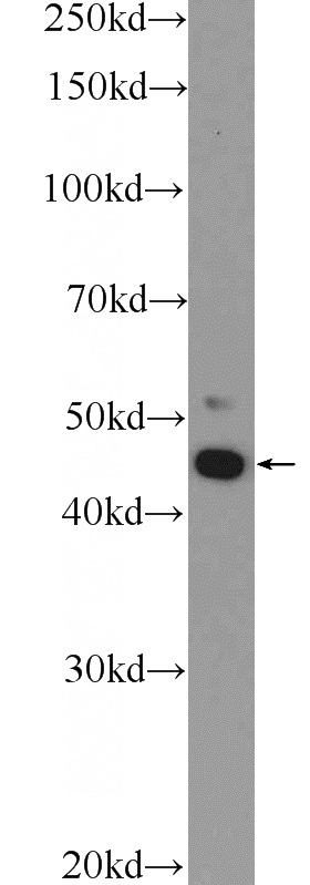 Jurkat cells were subjected to SDS PAGE followed by western blot with Catalog No:111651(IKZF5 Antibody) at dilution of 1:300