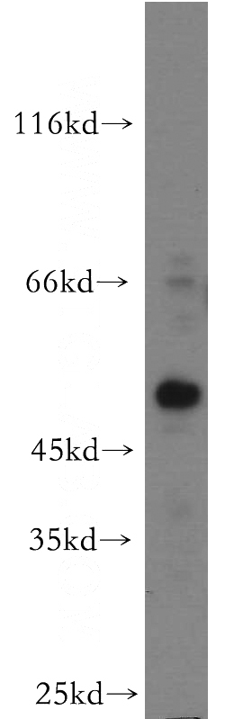 HeLa cells were subjected to SDS PAGE followed by western blot with Catalog No:111536(HOXC10 antibody) at dilution of 1:500