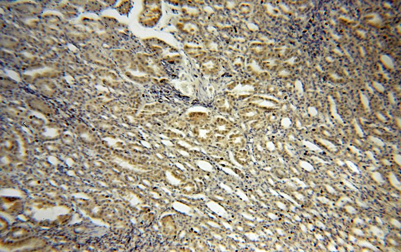 Immunohistochemical of paraffin-embedded human kidney using Catalog No:115250(SIX2 antibody) at dilution of 1:50 (under 10x lens)