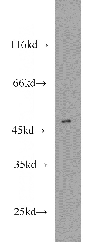 SH-SY5Y cells were subjected to SDS PAGE followed by western blot with Catalog No:109396(CLN3 antibody) at dilution of 1:800