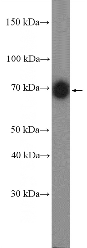 mouse brain tissue were subjected to SDS PAGE followed by western blot with Catalog No:113561(NGFR Antibody) at dilution of 1:1000