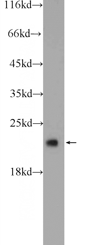 HEK-293 cells were subjected to SDS PAGE followed by western blot with Catalog No:109445(COMMD8 Antibody) at dilution of 1:600