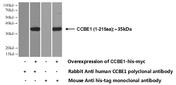 Transfected HEK-293 cells were subjected to SDS PAGE followed by western blot with Catalog No:108955(CCBE1 Antibody) at dilution of 1:700