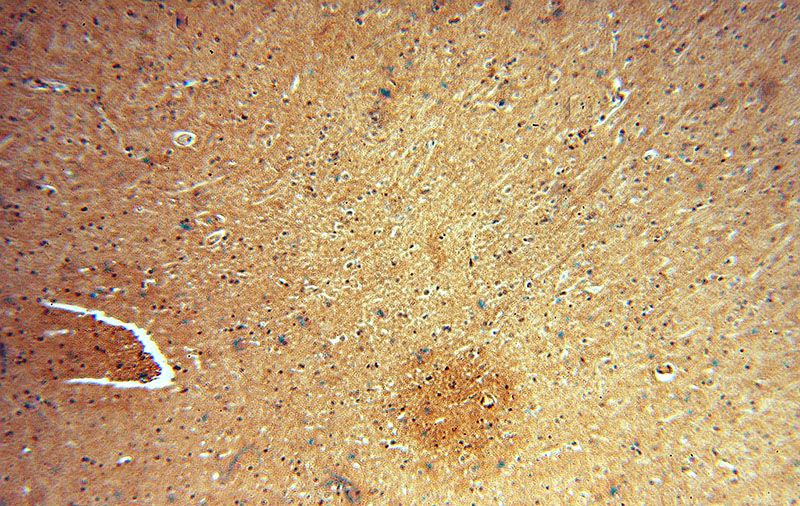 Immunohistochemical of paraffin-embedded human brain using Catalog No:109978(DISC1-long-specific antibody) at dilution of 1:50 (under 10x lens)