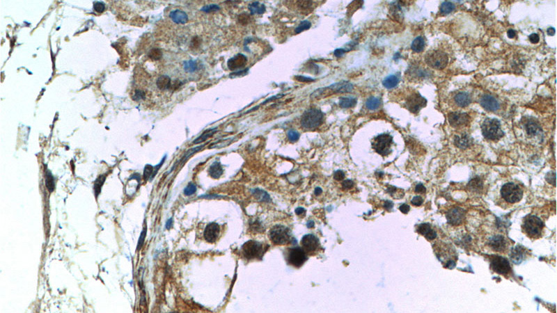 Immunohistochemistry of paraffin-embedded human testis tissue slide using Catalog No:108983(CCDC62 Antibody) at dilution of 1:50 (under 40x lens)