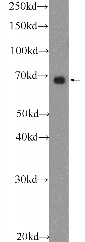 HEK-293 cells were subjected to SDS PAGE followed by western blot with Catalog No:114315(PTPN11 Antibody) at dilution of 1:600