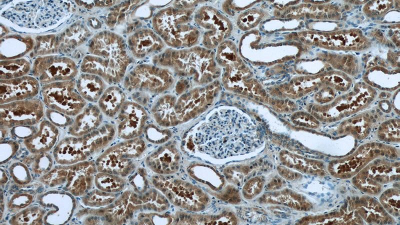 Immunohistochemistry of paraffin-embedded human kidney tissue slide using Catalog No:110212(EFTUD1 Antibody) at dilution of 1:50 (under 10x lens)