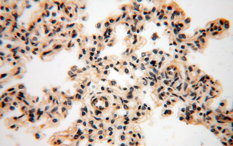 Immunohistochemical of paraffin-embedded human lung using Catalog No:110851(GALNTL5 antibody) at dilution of 1:100 (under 40x lens)