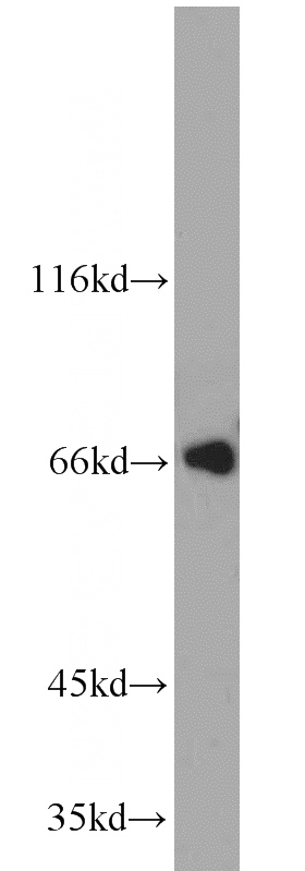 Jurkat cells were subjected to SDS PAGE followed by western blot with Catalog No:115947(TERF2 antibody) at dilution of 1:1000