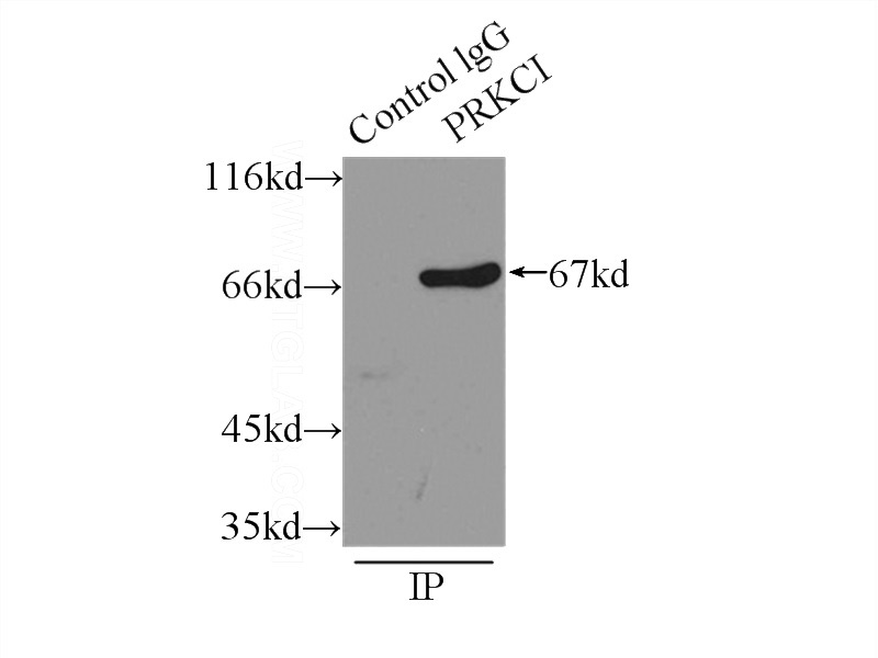 IP Result of anti-PRKCI (IP:Catalog No:113852, 3ug; Detection:Catalog No:113852 1:500) with HeLa cells lysate 2500ug.