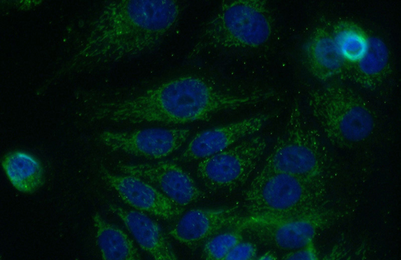 Immunofluorescent analysis of MCF-7 cells using Catalog No:112096(KLHL2 Antibody) at dilution of 1:50 and Alexa Fluor 488-congugated AffiniPure Goat Anti-Rabbit IgG(H+L)