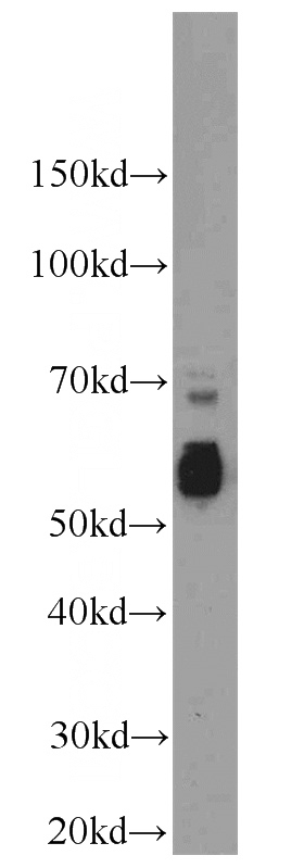 K-562 cells were subjected to SDS PAGE followed by western blot with Catalog No:109098(CDC25C antibody) at dilution of 1:800
