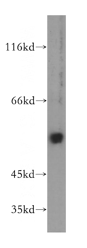 HeLa cells were subjected to SDS PAGE followed by western blot with Catalog No:116622(uPA antibody) at dilution of 1:500