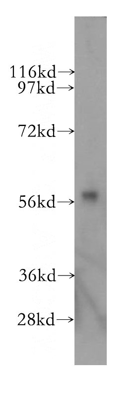 human brain tissue were subjected to SDS PAGE followed by western blot with Catalog No:109702(CYP46A1 antibody) at dilution of 1:500