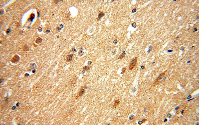 Immunohistochemical of paraffin-embedded human brain using Catalog No:111796(ING4-specific antibody) at dilution of 1:50 (under 40x lens)