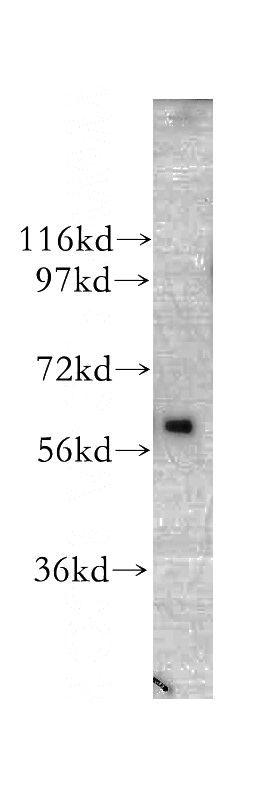 human brain tissue were subjected to SDS PAGE followed by western blot with Catalog No:109172(CDR2 antibody) at dilution of 1:500