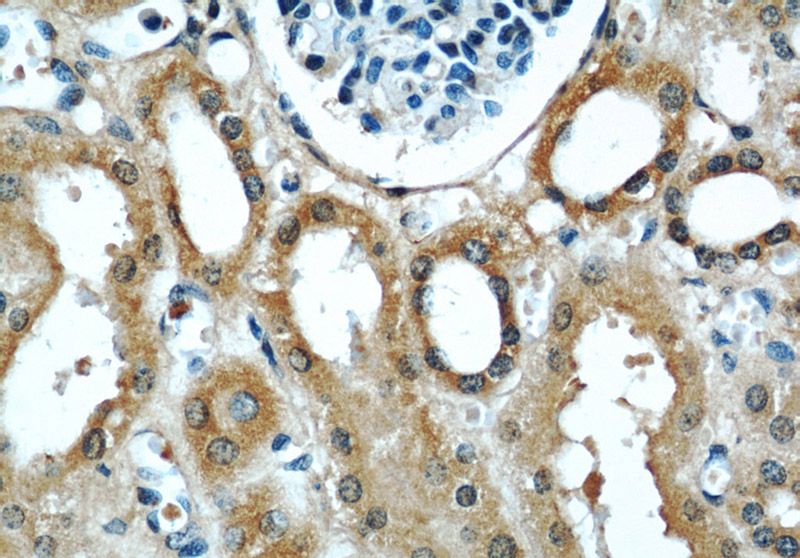 Immunohistochemistry of paraffin-embedded human kidney slide using Catalog No:116625(UPF1 Antibody) at dilution of 1:50