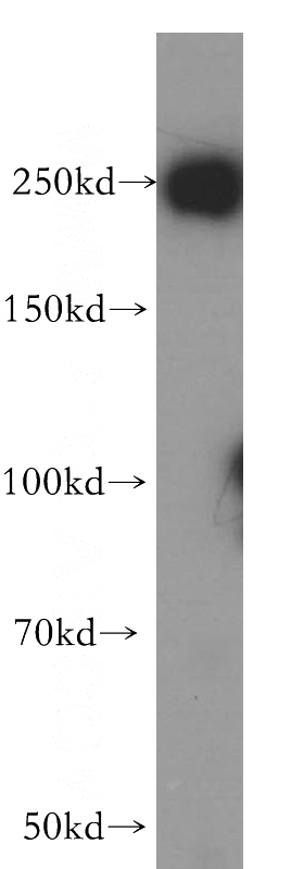 HeLa cells were subjected to SDS PAGE followed by western blot with Catalog No:116605(USP32 antibody) at dilution of 1:400