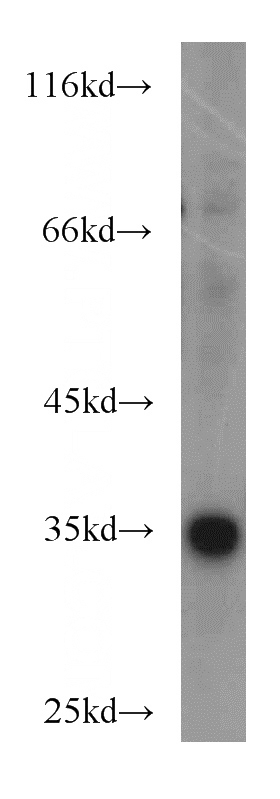 MCF7 cells were subjected to SDS PAGE followed by western blot with Catalog No:114144(PPP1CC antibody) at dilution of 1:300