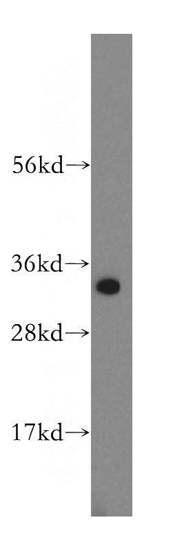 HeLa cells were subjected to SDS PAGE followed by western blot with Catalog No:112766(MTCH2 antibody) at dilution of 1:1000