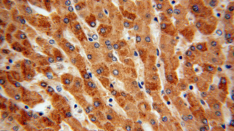 Immunohistochemical of paraffin-embedded human liver using Catalog No:115920(TCTN2 antibody) at dilution of 1:100 (under 40x lens)