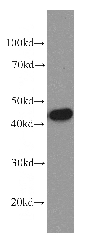 HeLa cells were subjected to SDS PAGE followed by western blot with Catalog No:107624(TIMM44 antibody) at dilution of 1:1000