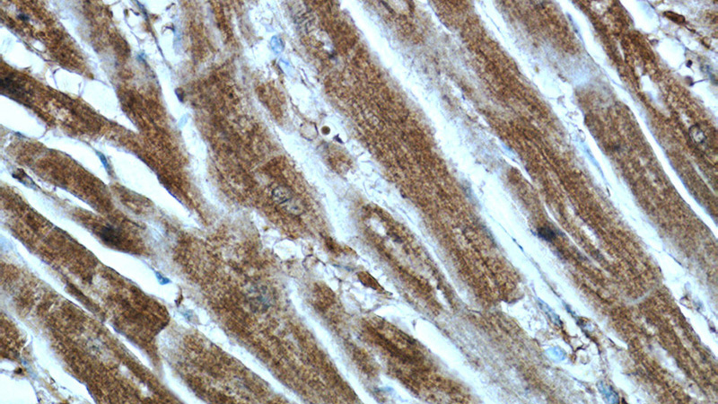 Immunohistochemistry of paraffin-embedded human heart tissue slide using Catalog No:111919(KBTBD10 Antibody) at dilution of 1:100 (under 40x lens)